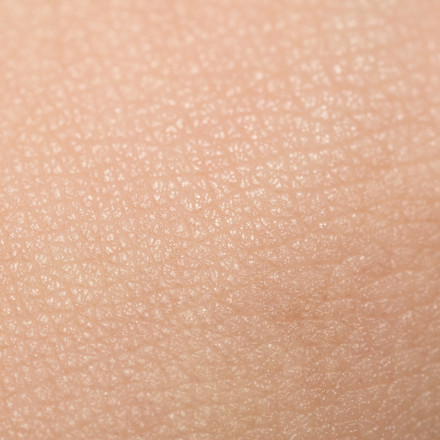 a close up of human skin